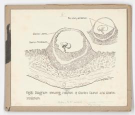 Relation of chorion leave and chorian frondosum,  for American Journal of Obstetrics and Gynecology