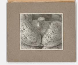 Gynecology and obstetrics illustrations