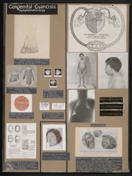 Exhibit panels regarding the heart