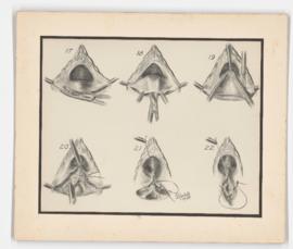 Manchester Operation