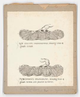 Diagrams of placenta, for American Journal of Obstetrics and Gynecology