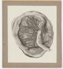 Placenta