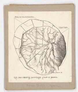 Centrifugal growth of placenta, for American Journal of Obstetrics and Gynecology
